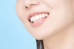 ワイヤー矯正以外の矯正装置にも対応！種類や特徴を紹介